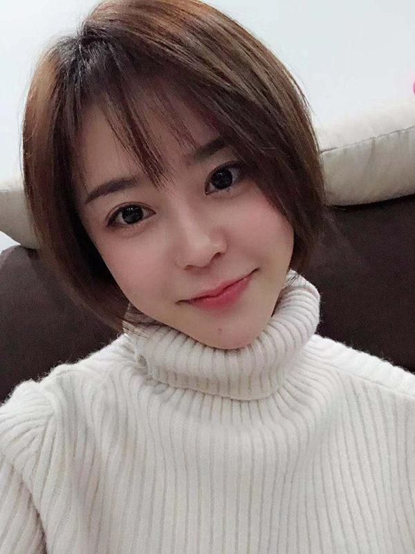 上海华美医疗美容医院徐文龙医生膨体隆鼻案例-整形美容案例 上海华美医疗美容医院徐文龙医生膨体隆鼻案例